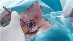 ##IMAGE##