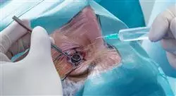 experto neurocirugía y cirugía oftalmológica para enfermería