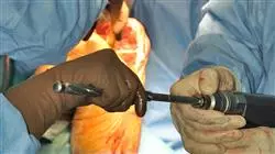 cursos cirugia ortopedica traumatologica enfermeria