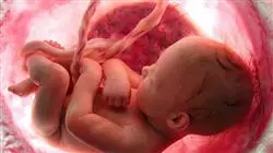 ##IMAGE##