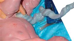 estudiar urgencias obstetricas neonatales enfermeria
