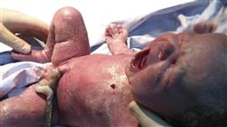 master online urgencias obstetricas neonatales enfermeria