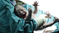 master urgencias obstetricas neonatales enfermeria