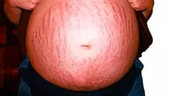 ##IMAGE##