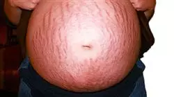 ##IMAGE##