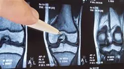 posgrado tecnicas diagnosticas hospitalizacion domiciliaria enfermeria