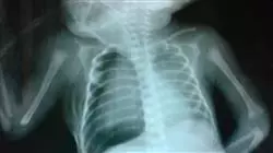 ##IMAGE##