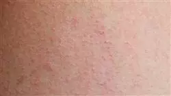##IMAGE##