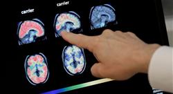 diplomado gerontología y estrés oxidativo en medicina integrativa para enfermería