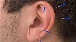 ##IMAGE##