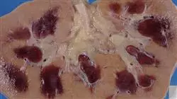 ##IMAGE##
