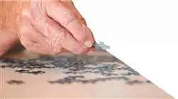 ##IMAGE##