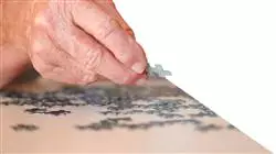 ##IMAGE##