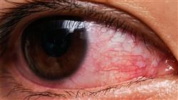 formacion patologia ocular