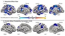 diplomado introduccion neuropsicologia