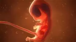 ##IMAGE##