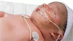 ##IMAGE##