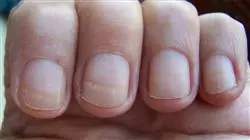 ##IMAGE##