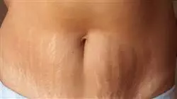 ##IMAGE##