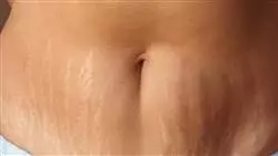 ##IMAGE##