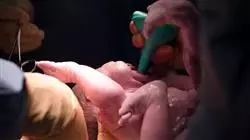 ##IMAGE##