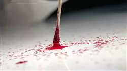 ##IMAGE##