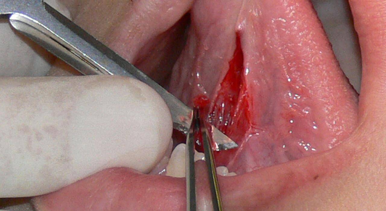 Maestría en Urgencias Pediátricas para Enfermería