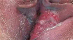 ##IMAGE##