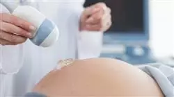 ##IMAGE##