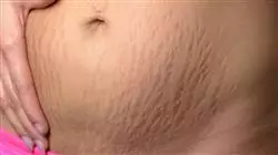 ##IMAGE##