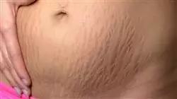 ##IMAGE##