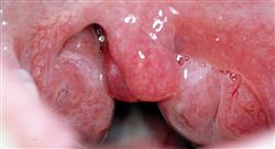 experto enfermedades infecciosas 1
