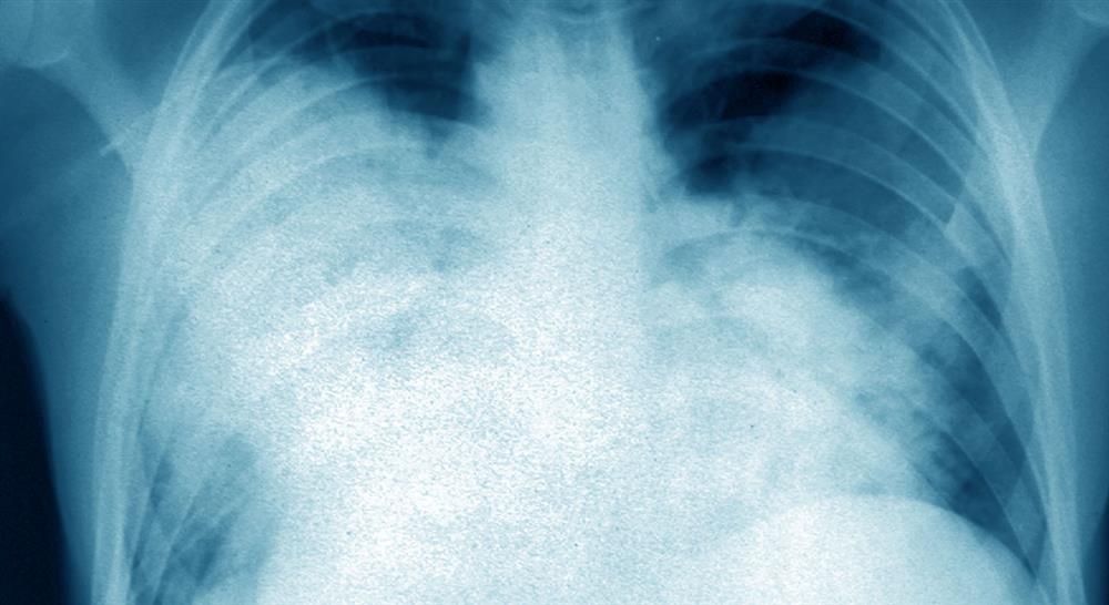 estudiar enfermedades infecciosas respiratorias y cardiovasculares en urgencias para enfermería