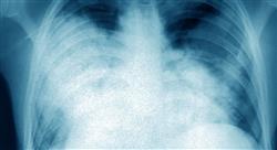 estudiar enfermedades infecciosas respiratorias y cardiovasculares en urgencias para enfermería