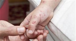 posgrado manejo fiebre urgencias 4