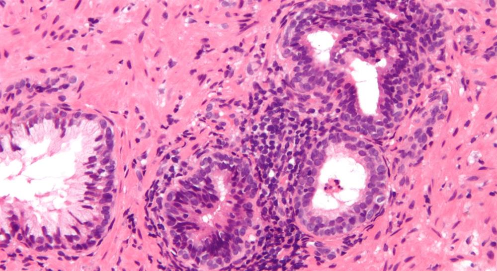Diplomado en Infecciones del Tracto Urinario, Genitales y de Transmisión Sexual en Urgencias para Enfermería