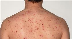 posgrado salud pública y enfermedad infecciosa en urgencias para enfermería