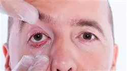 ##IMAGE##