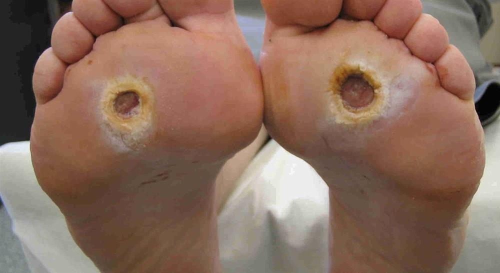 formacion infecciones osteoarticulares piel y partes blandas en urgencias para enfermería
