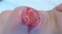 ##IMAGE##