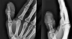 curso infecciones osteoarticulares piel y partes blandas en urgencias para enfermería