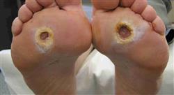 formacion infecciones osteoarticulares piel y partes blandas en urgencias para enfermería