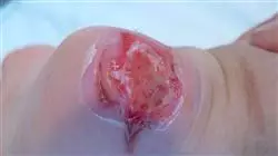##IMAGE##