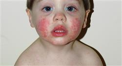 formacion enfermedades infecciosas en urgencias del paciente pediátrico para enfermería