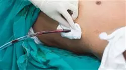diplomado online patologia respiratoria enfermeria