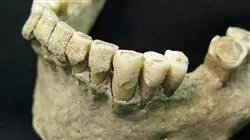 ##IMAGE##