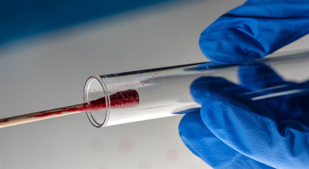 especializacion antropología y psicología forense para enfermería