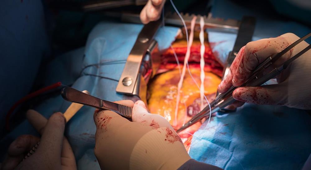 formacion cirugía cardiaca para enfermería