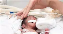 curso online problemas durante la lactancia materna para matronas