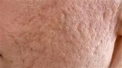 ##IMAGE##
